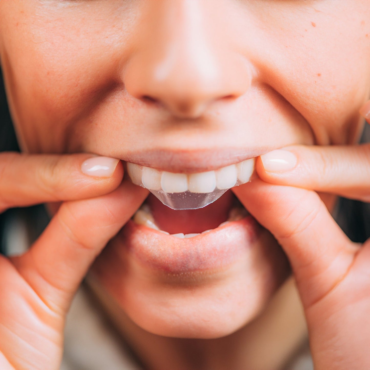 Professional Teeth Whitening Strips - 28ct