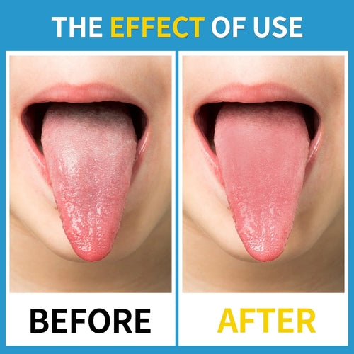 Stainless Steel Fresh Breath Tongue Scraper 2pk